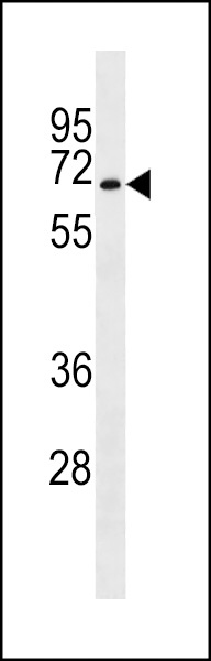 STKLD1 Antibody