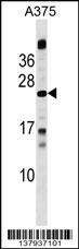 MBD3L1 Antibody