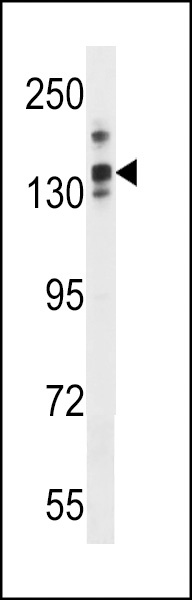 LRRC16A Antibody