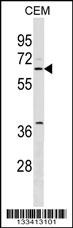 SPATS2L Antibody