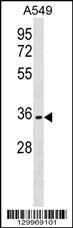 OR51B6 Antibody