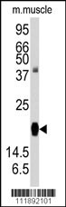 RGS19 Antibody