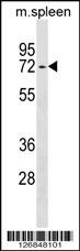 ENTPD4 Antibody