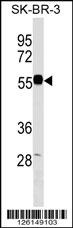 EEPD1 Antibody