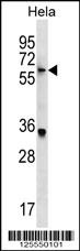 KLHL22 Antibody