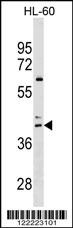 CCR4 Antibody