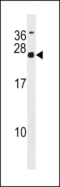 MRGBP Antibody