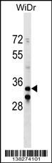 ITGB1BP2 Antibody