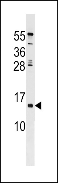 HHLA3 Antibody
