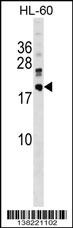 DNAJC30 Antibody