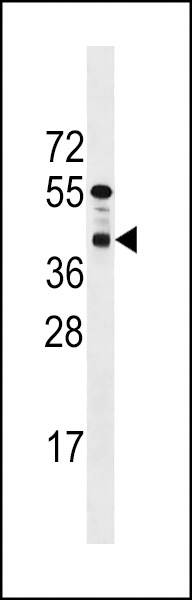 PPTC7 Antibody