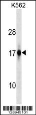 ZFAND2A Antibody