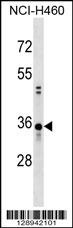 CCDC137 Antibody