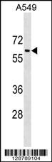 TRAM1L1 Antibody