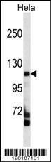 FAM65C Antibody