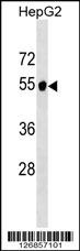 GPT2 Antibody