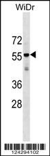 AGPAT9 Antibody