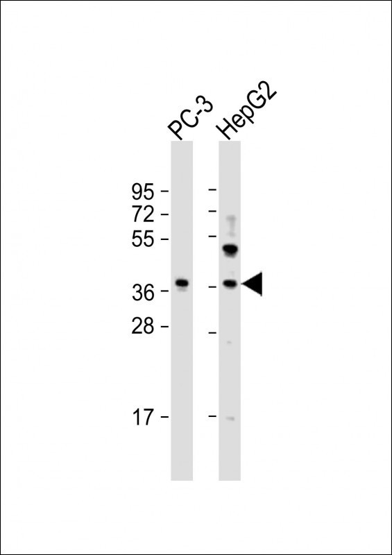 LGALS8 Antibody