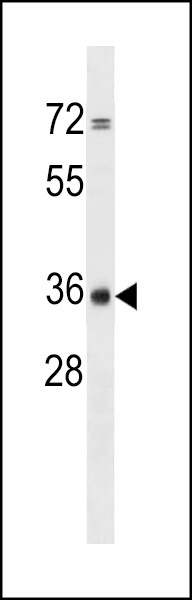 CPPED1 Antibody