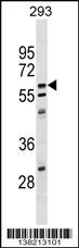 CPNE5 Antibody