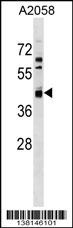 AMDHD2 Antibody