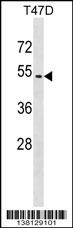 ZNF713 Antibody