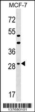 DHRS11 Antibody