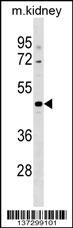 CCDC91 Antibody