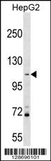 PROSER1 Antibody
