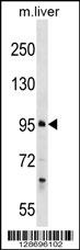 PROSER1 Antibody