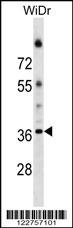 ALG5 Antibody