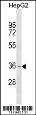 DHRS1 Antibody