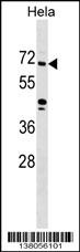 ZNF280B Antibody