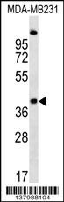 RQCD1 Antibody