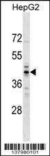 TRMT10A Antibody