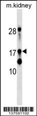 DR1 Antibody