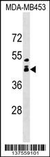 ALX1 Antibody