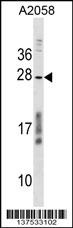CCDC144NL Antibody
