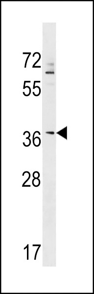 ZNF385A Antibody