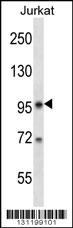 U2SURP Antibody