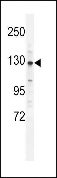 CLIP2 Antibody