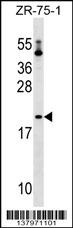 PTRH1 Antibody