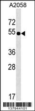 SLC9B2 Antibody