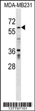 ZNF543 Antibody
