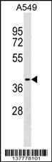 ZCCHC12 Antibody