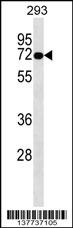 OTOP2 Antibody