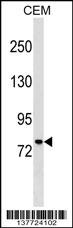 MUM1 Antibody