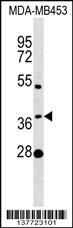 MTHFSD Antibody