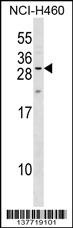 MPZL2 Antibody