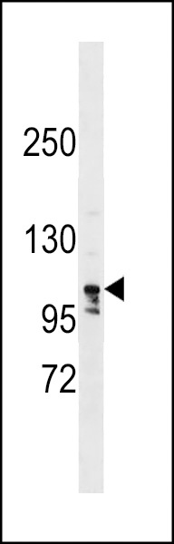 LARP1B Antibody